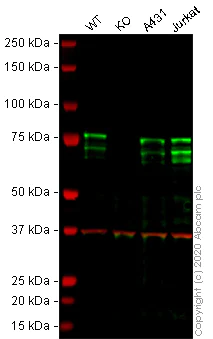 Western blot - Anti-MBD1 antibody [EPR3564] - BSA and Azide free (AB247676)