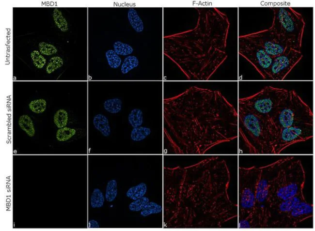 Immunocytochemistry/ Immunofluorescence - Anti-MBD1 antibody [RP23040267] (AB313550)