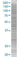 MBD1 overexpression 293T lysate (whole cell)
