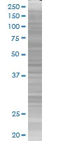 SDS-PAGE - MBD1 overexpression 293T lysate (whole cell) (AB94263)