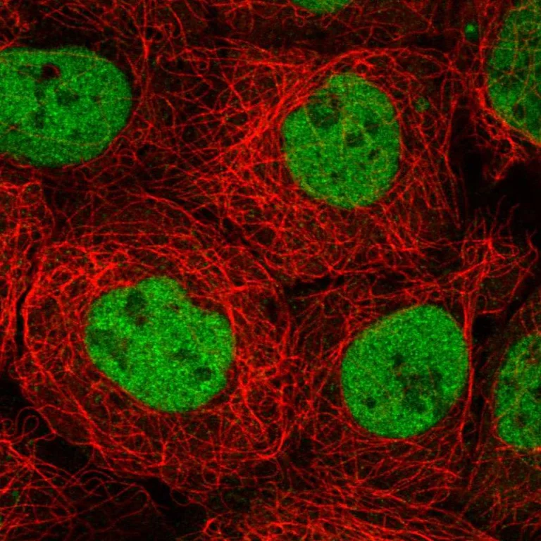 Immunocytochemistry/ Immunofluorescence - Anti-MBD2 Antibody (AB327268)