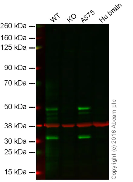 Western blot - Anti-MBD2 antibody [EPR18361] (AB188474)