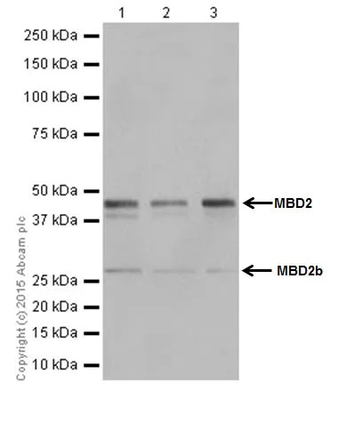 Western blot - Anti-MBD2 antibody [EPR18361] (AB188474)