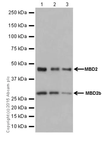 Western blot - Anti-MBD2 antibody [EPR18361] (AB188474)