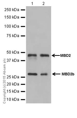 Western blot - Anti-MBD2 antibody [EPR18361] (AB188474)