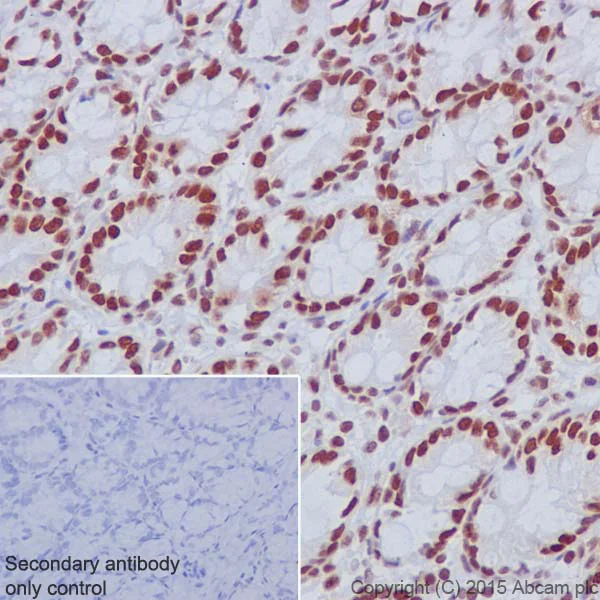 Immunohistochemistry (Formalin/PFA-fixed paraffin-embedded sections) - Anti-MBD2 antibody [EPR18361] - BSA and Azide free (AB224274)