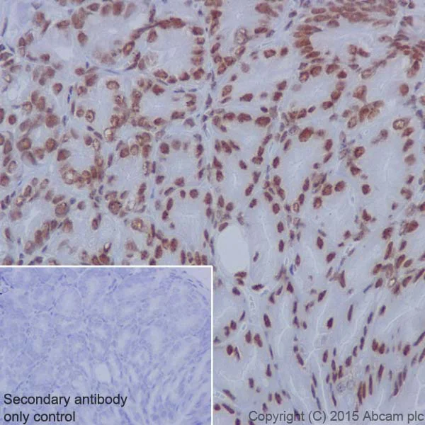 Immunohistochemistry (Formalin/PFA-fixed paraffin-embedded sections) - Anti-MBD2 antibody [EPR18361] - BSA and Azide free (AB224274)