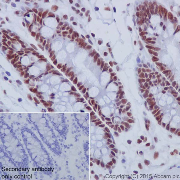 Immunohistochemistry (Formalin/PFA-fixed paraffin-embedded sections) - Anti-MBD2 antibody [EPR18361] - BSA and Azide free (AB224274)