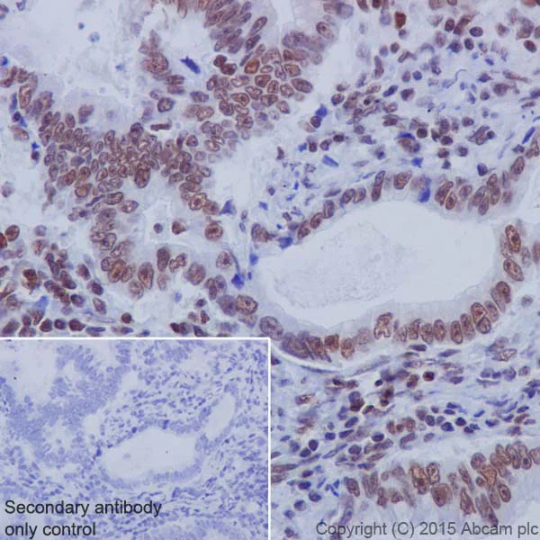 Immunohistochemistry (Formalin/PFA-fixed paraffin-embedded sections) - Anti-MBD2 antibody [EPR18361] - BSA and Azide free (AB224274)