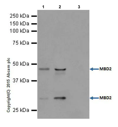 Immunoprecipitation - Anti-MBD2 antibody [EPR18361] - BSA and Azide free (AB224274)