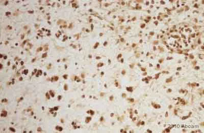 Immunohistochemistry (Formalin/PFA-fixed paraffin-embedded sections) - Anti-MBD2 + MBD3 antibody [106B691] (AB45027)