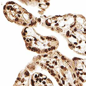 Immunohistochemistry (Formalin/PFA-fixed paraffin-embedded sections) - Anti-MBD2 + MBD3 antibody [106B691] (AB45027)