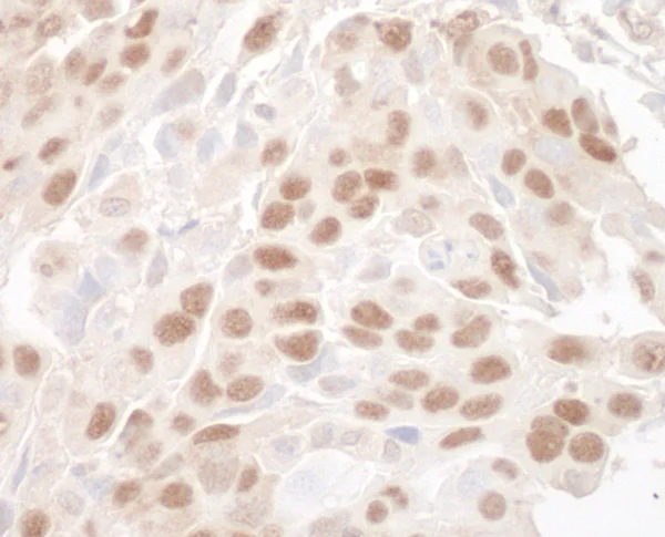 Immunohistochemistry (Formalin/PFA-fixed paraffin-embedded sections) - Anti-MBD3 antibody (AB91458)