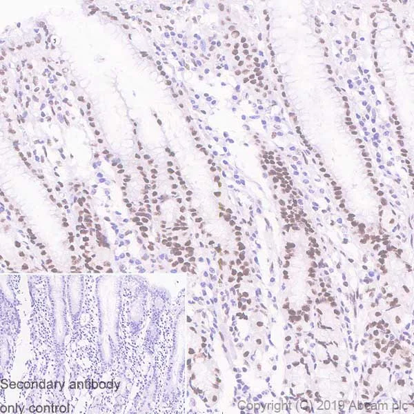 Immunohistochemistry (Formalin/PFA-fixed paraffin-embedded sections) - Anti-MBD3 antibody [EPR18258] (AB188401)