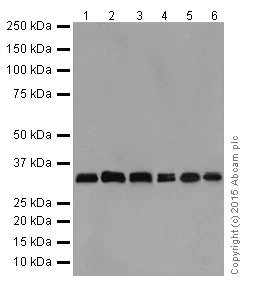 Western blot - Anti-MBD3 antibody [EPR18258] (AB188401)
