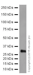 Western blot - Anti-MBD3 antibody [EPR18258] (AB188401)