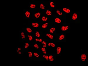 Immunocytochemistry/ Immunofluorescence - Anti-MBD3 antibody [EPR9913] - BSA and Azide free (AB240144)