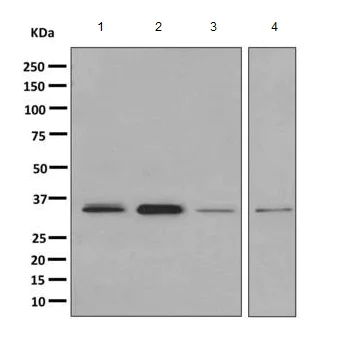 Western blot - Anti-MBD3 antibody [EPR9913] - ChIP Grade (AB157464)