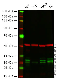 Western blot - Anti-MBD3 antibody [EPR9913] - ChIP Grade (AB157464)