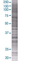 MBD3 overexpression 293T lysate (whole cell)