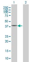 Western blot - MBD3 overexpression 293T lysate (whole cell) (AB94293)