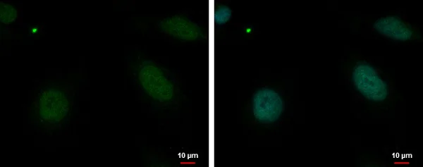 Immunocytochemistry/ Immunofluorescence - Anti-MBD4/MED1 antibody (AB227625)