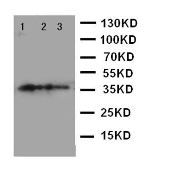 Western blot - Anti-MBD4/MED1 antibody - C-terminal (AB191037), expandable thumbnail