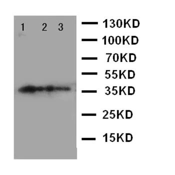 Western blot - Anti-MBD4/MED1 antibody - C-terminal (AB191037)