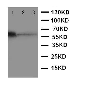 Western blot - Anti-MBD4/MED1 antibody - C-terminal (AB191037)
