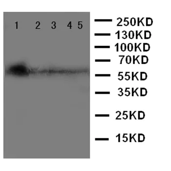 Western blot - Anti-MBD4/MED1 antibody - C-terminal (AB191037)