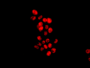 Immunocytochemistry/ Immunofluorescence - Anti-MBIP antibody [EPR13952] (AB181040)