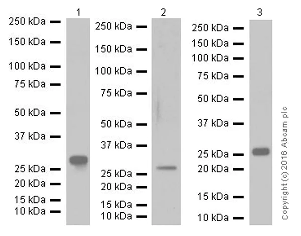 Western blot - Anti-MBL1+MBL2 antibody [EPR18381-156] (AB190834)