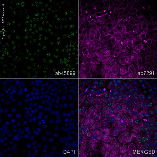 Immunocytochemistry/ Immunofluorescence - Anti-MBNL1 antibody (AB45899)