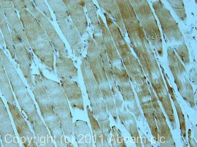 Immunohistochemistry (Formalin/PFA-fixed paraffin-embedded sections) - Anti-MBNL1 antibody (AB45899)