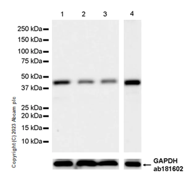 Western blot - Anti-MBNL1 antibody [EPR26983-11] - BSA and Azide free (AB309349)