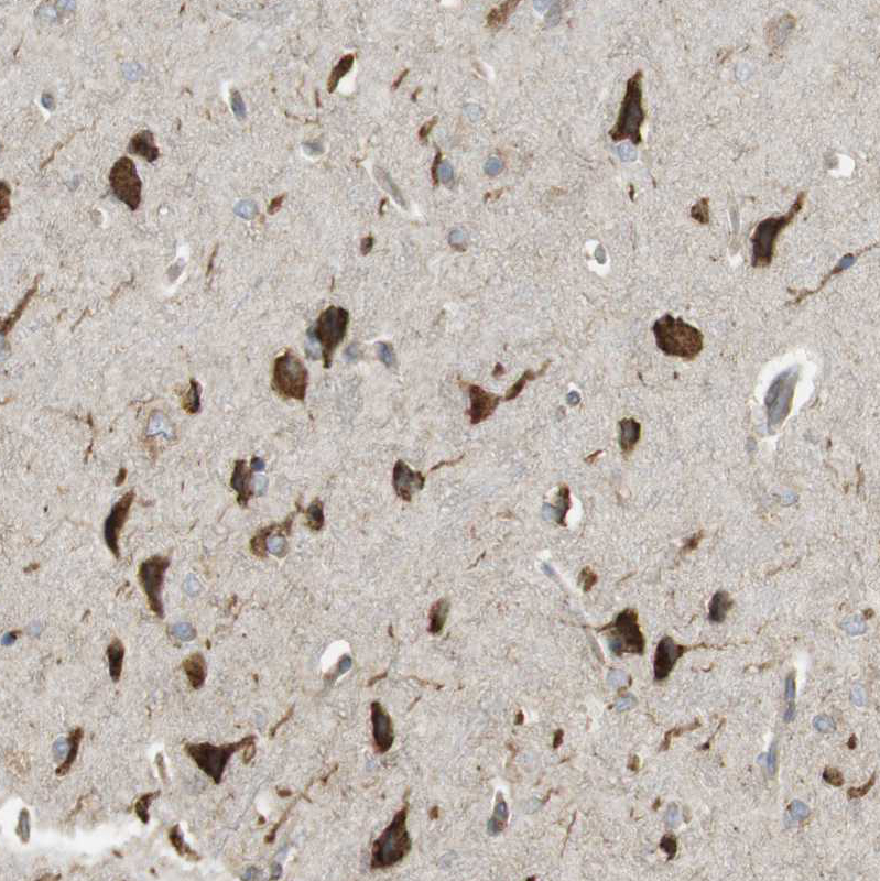 Immunohistochemistry (Formalin/PFA-fixed paraffin-embedded sections) - Anti-MBOAT2 antibody (AB121453)