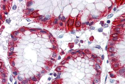 Immunohistochemistry (Formalin/PFA-fixed paraffin-embedded sections) - Anti-MBOAT4 antibody (AB140889)