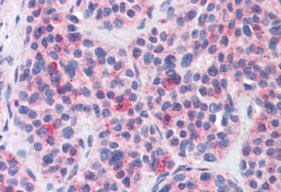 Immunohistochemistry (Formalin/PFA-fixed paraffin-embedded sections) - Anti-MBOAT4 antibody (AB140889)