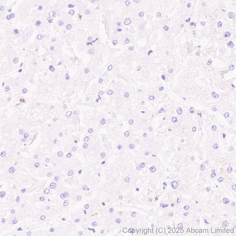 Immunohistochemistry (Formalin/PFA-fixed paraffin-embedded sections) - Anti-MBOAT7 antibody [EPR30427-503] (AB325494)