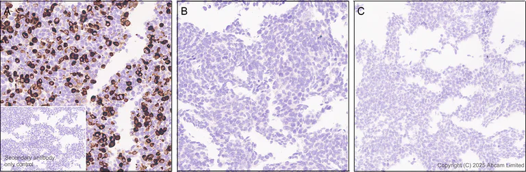 Immunohistochemistry (Formalin/PFA-fixed paraffin-embedded sections) - Anti-MBOAT7 antibody [EPR30427-503] (AB325494)