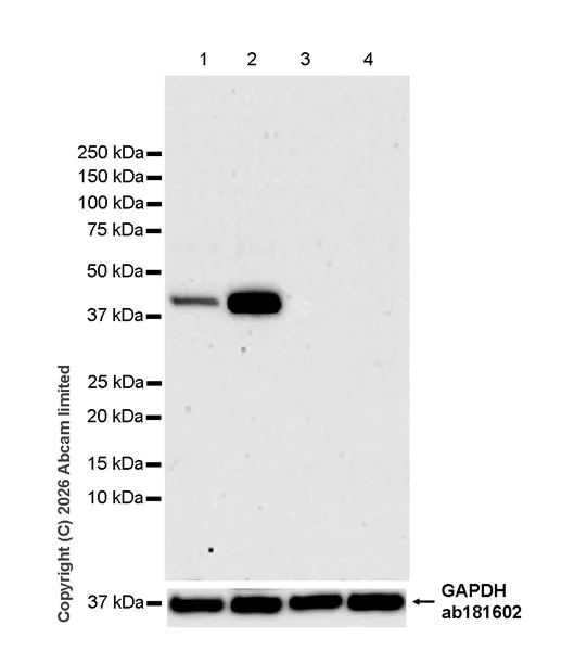 Western blot - Anti-MBOAT7 antibody [EPR30427-503] (AB325494)
