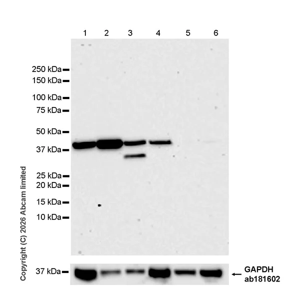 Western blot - Anti-MBOAT7 antibody [EPR30427-503] (AB325494)