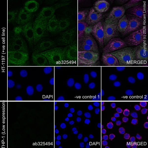 Immunocytochemistry/ Immunofluorescence - Anti-MBOAT7 antibody [EPR30427-503] - BSA and Azide free (AB325504)