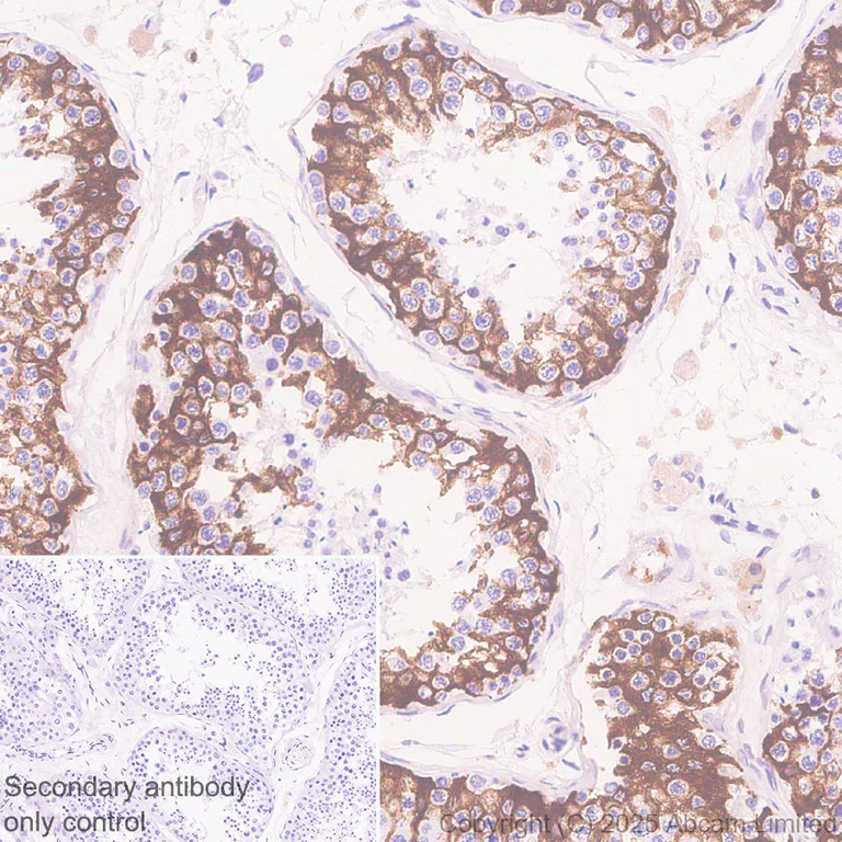 Immunohistochemistry (Formalin/PFA-fixed paraffin-embedded sections) - Anti-MBOAT7 antibody [EPR30427-503] - BSA and Azide free (AB325504)