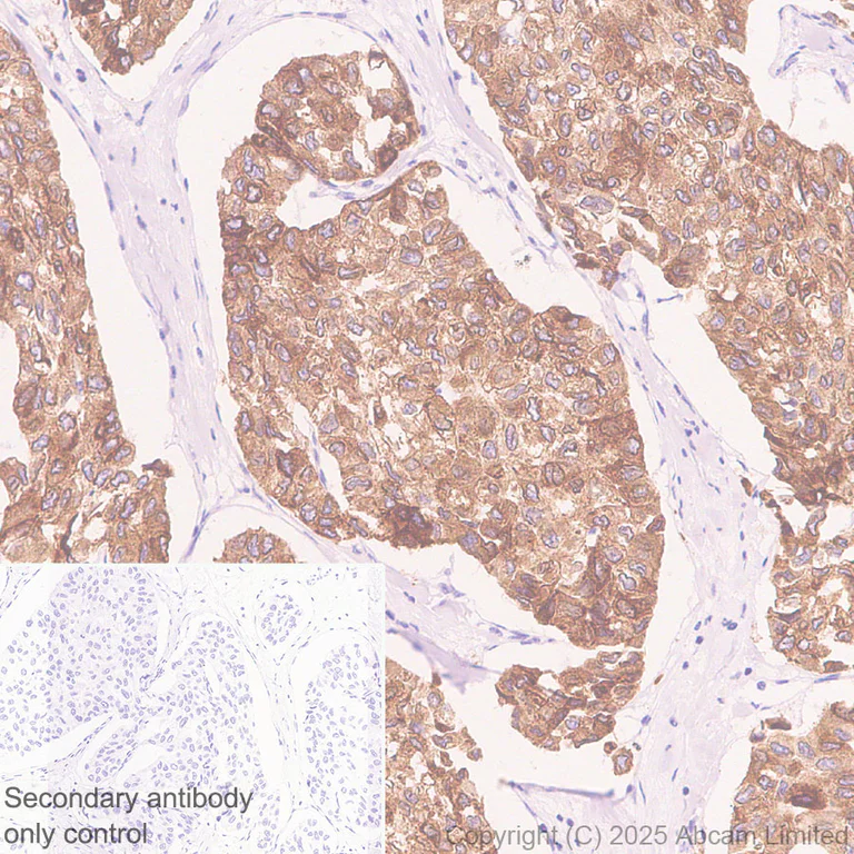 Immunohistochemistry (Formalin/PFA-fixed paraffin-embedded sections) - Anti-MBOAT7 antibody [EPR30427-503] - BSA and Azide free (AB325504)