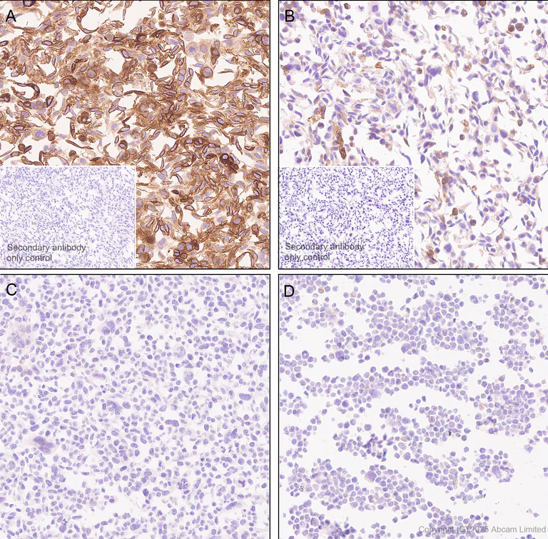 Immunohistochemistry (Formalin/PFA-fixed paraffin-embedded sections) - Anti-MBOAT7 antibody [EPR30427-503] - BSA and Azide free (AB325504)