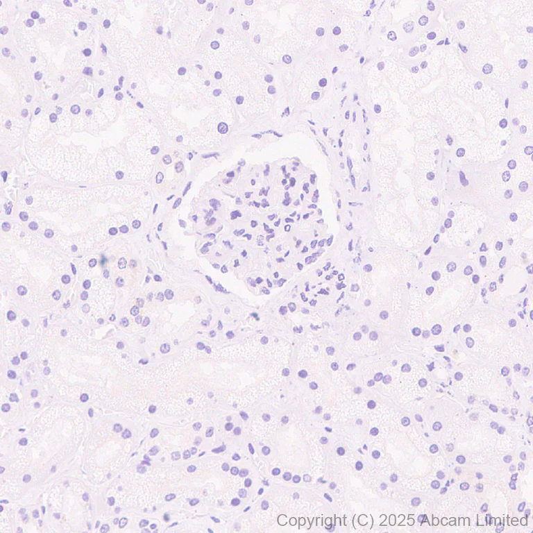 Immunohistochemistry (Formalin/PFA-fixed paraffin-embedded sections) - Anti-MBOAT7 antibody [EPR30427-503] - BSA and Azide free (AB325504)