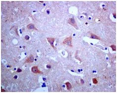 Immunohistochemistry (Formalin/PFA-fixed paraffin-embedded sections) - Anti-MC-2 antibody [EPR8386] - BSA and Azide free (AB248599)