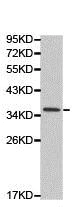 Western blot - Anti-MC1-R antibody (AB180776)