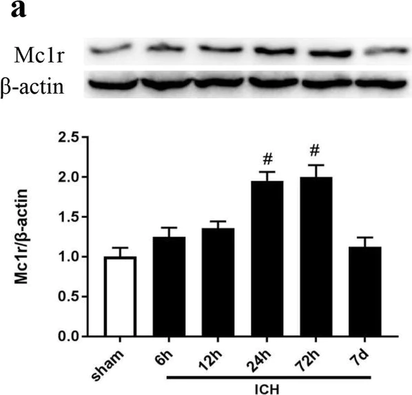 Western blot - Anti-MC1-R antibody (AB180776)